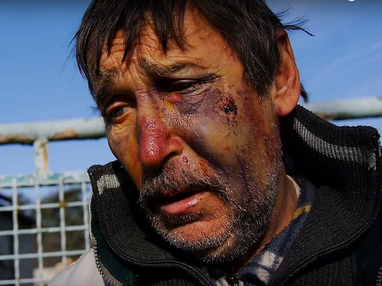 Philippe Layat, l'agriculteur opposant au Grand Stade, tabassé chez lui Philippe Layat, l'agriculteur opposant au Grand Stade, tabassé chez lui